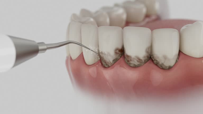 Reliable Dental Implants contractor in Murfreesboro, TN by Smile Center Dentistry